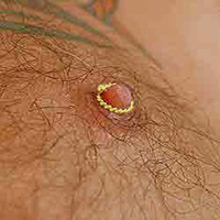 Non-piercing adjustable gold nipple rings for men.