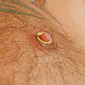 Non-piercing gold plated nipple rings for men.